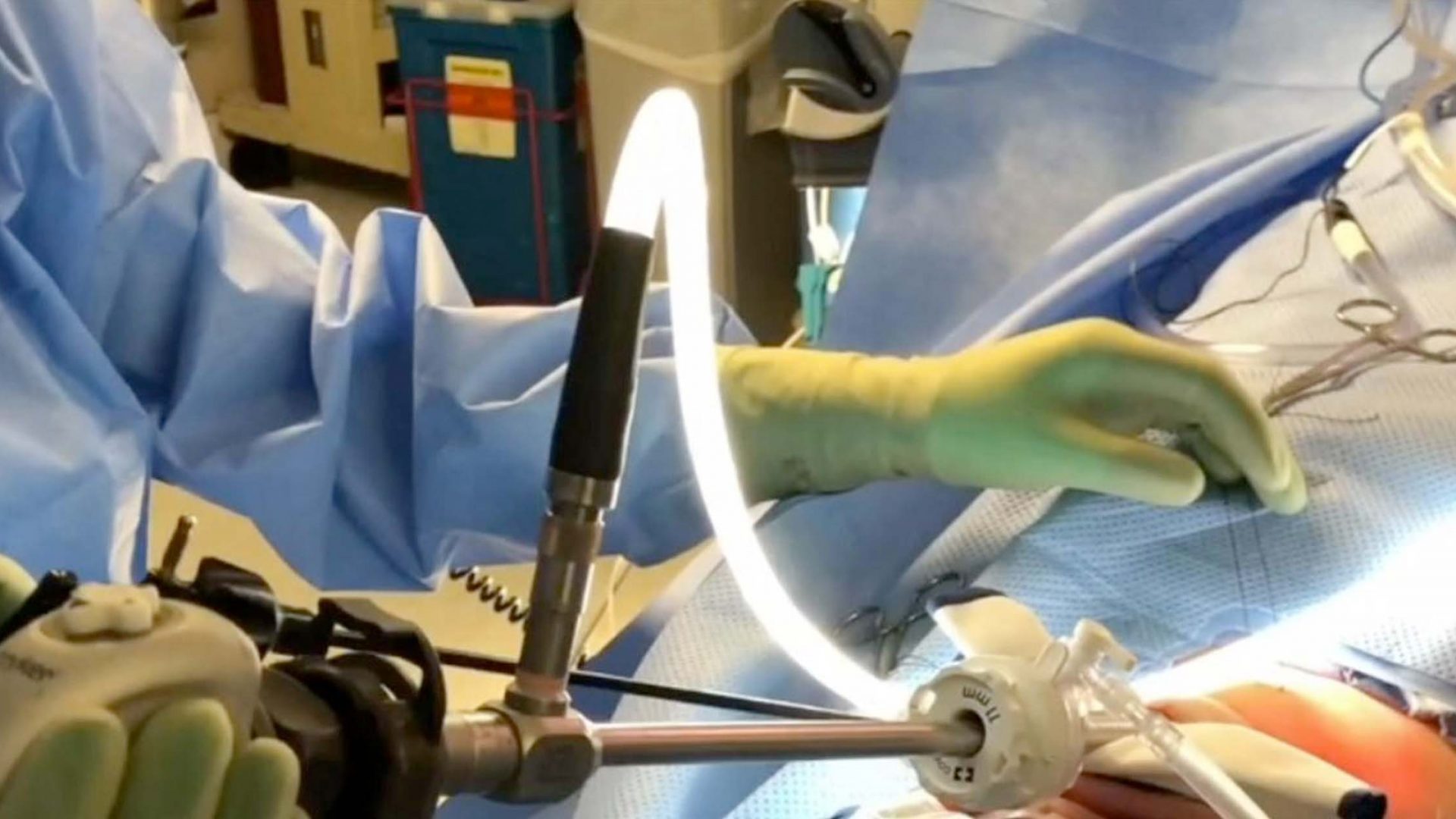 Doctor Performing Thyroidectomy
