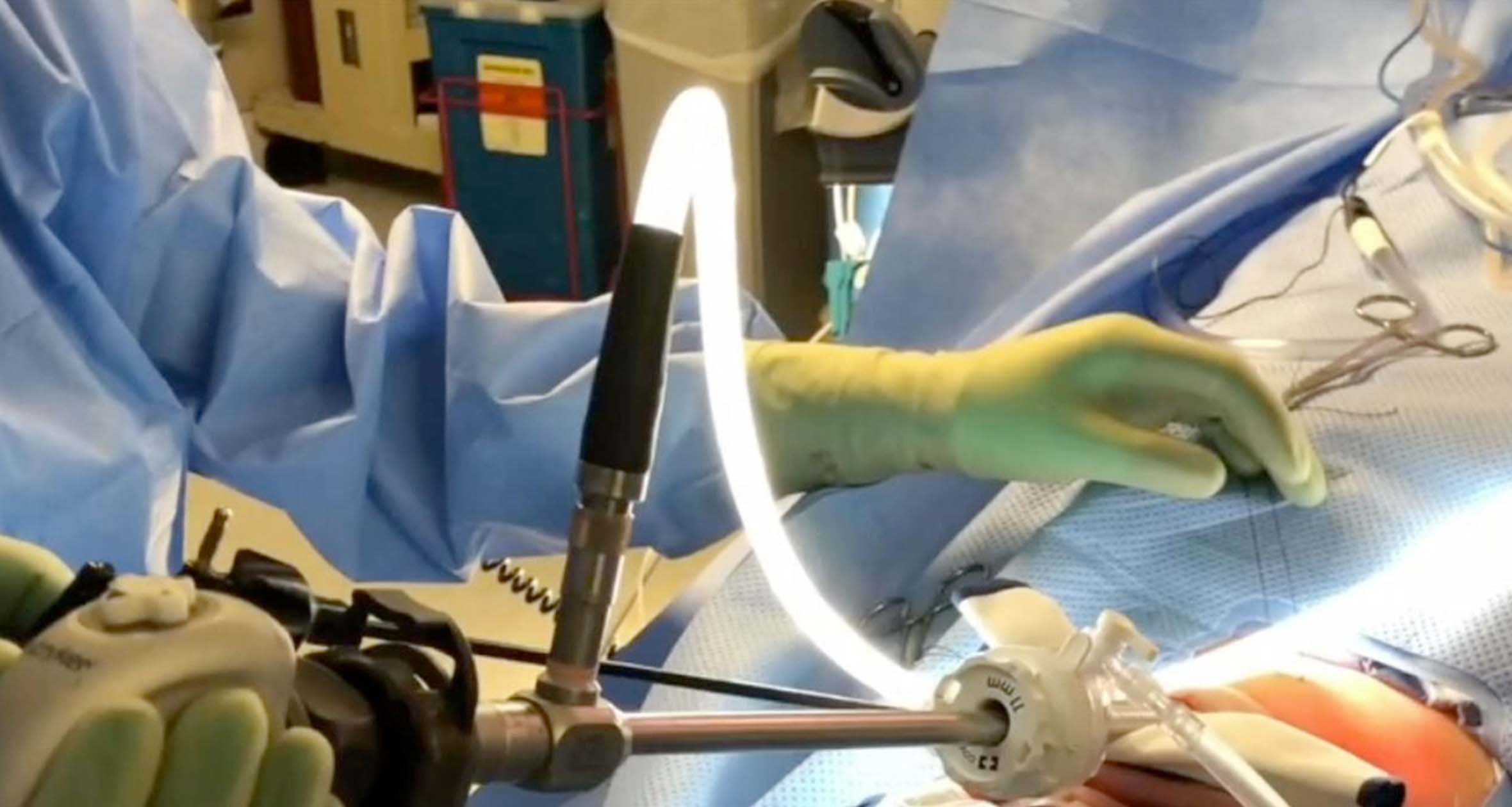 TOaST: a Thyroidectomy Innovation Spares Patients Highly Visible Scars ...