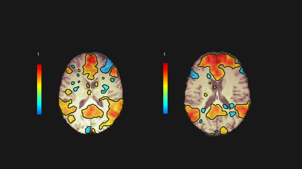 Image of Medical fMRI