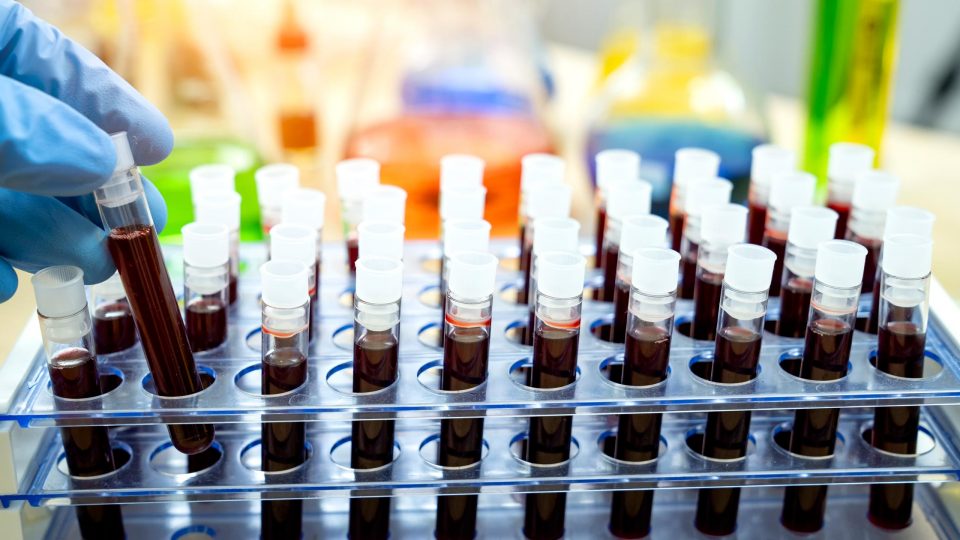 Blood Sample Vials in Laboratory