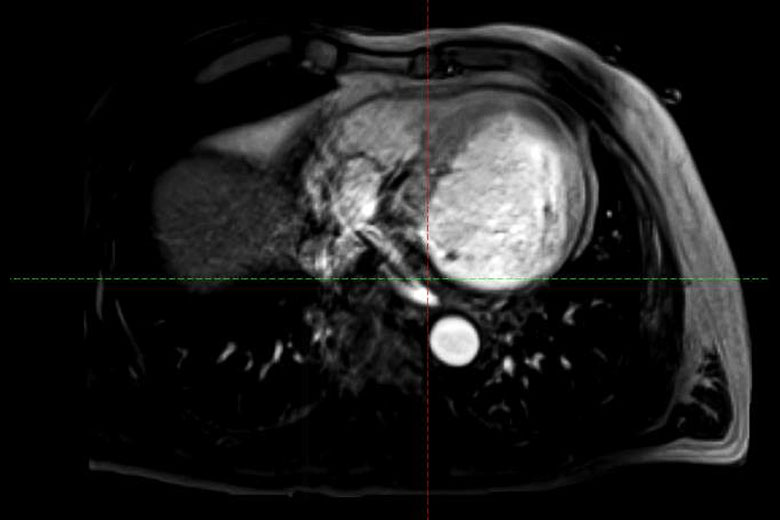 Cardiac CT Scan