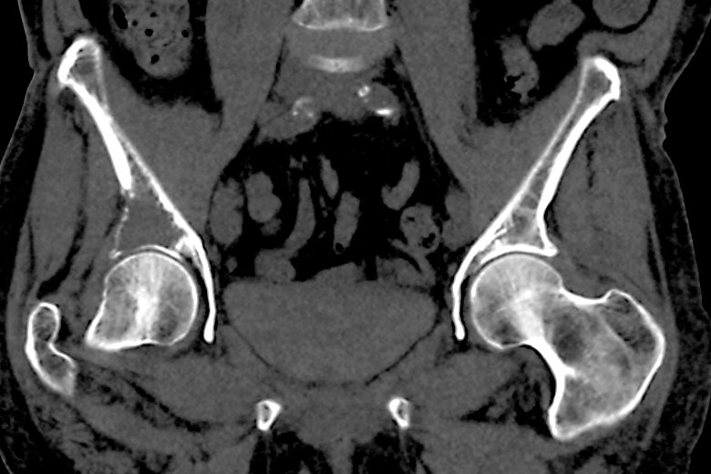 CT Imaging