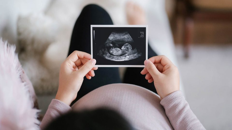 Pregnant person laying on couch holding up ultrasound image of fetus