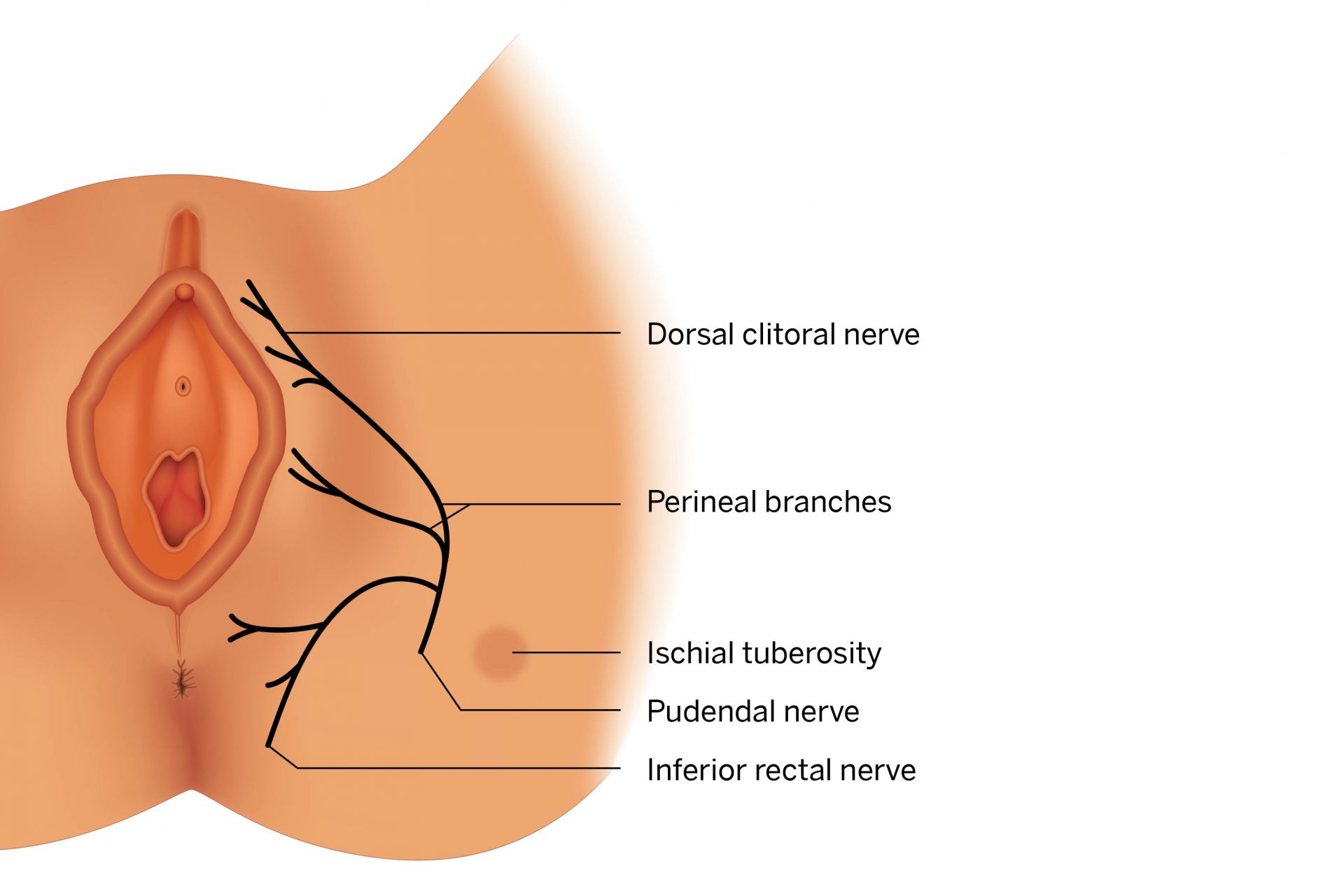 Pudendal Nerve Irritation and Perineal Pain