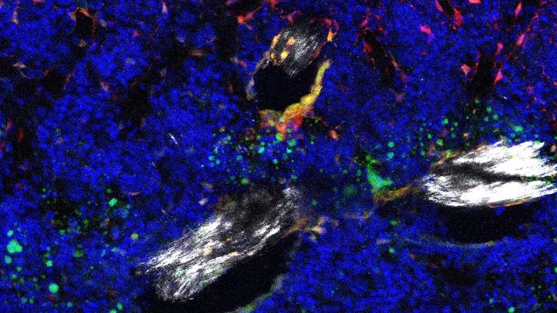 Immunofluorescence microscopy showing bone and fat precursor cells (red and green) in the aged mouse bone marrow