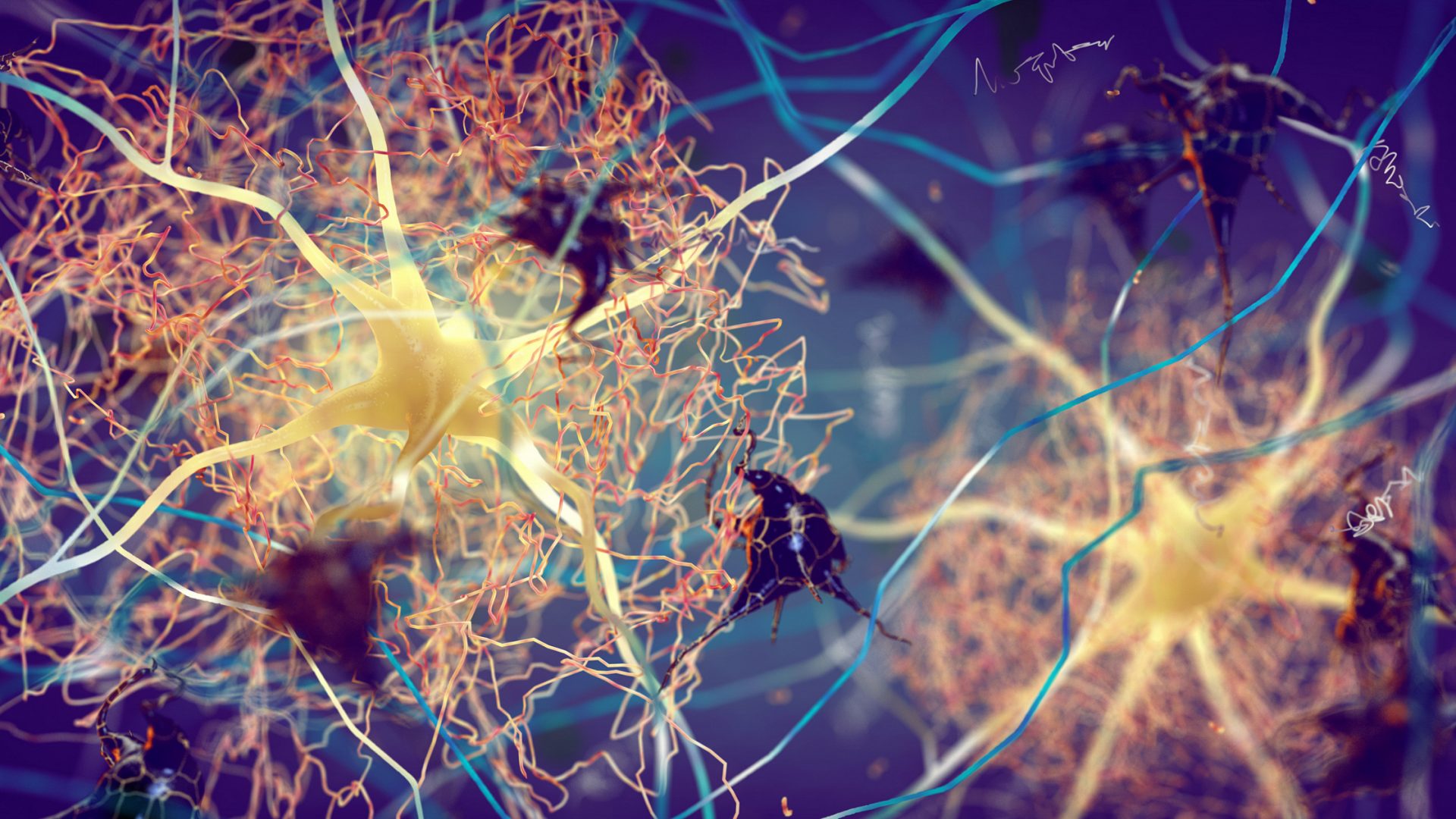 Artist’s rendering of Beta-amyloid protein disrupting nerve cells function in a brain with Alzheimer's disease